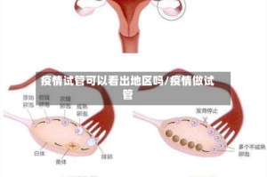 疫情试管可以看出地区吗/疫情做试管