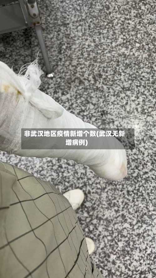 非武汉地区疫情新增个数(武汉无新增病例)-第1张图片