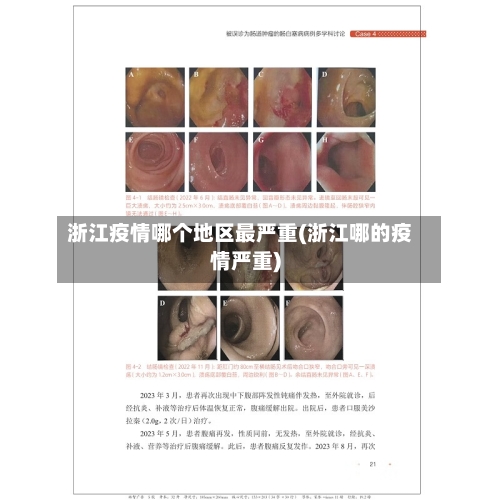 浙江疫情哪个地区最严重(浙江哪的疫情严重)-第3张图片